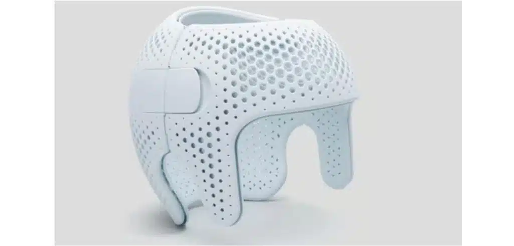 Intresset för 3D-skrivare växer Inom hälso- och sjukvården har 3D-printing medfört banbrytande framsteg som anpassade proteser, patientspecifika implantat,  och anatomiska modeller för kirurgisk planering är bara några exempel. Text och bild från Addinors hemsida